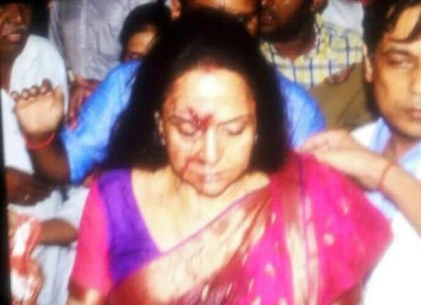 Hema Malini accident: A four year old girl killed!
