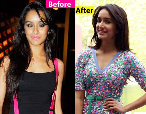 These 7 Actresses looks so Different nw after Surgery | 4809311