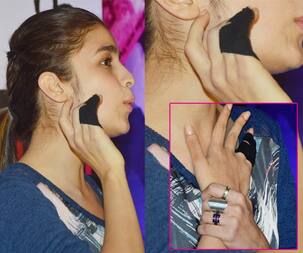 Alia Bhatt gets injured while working out!