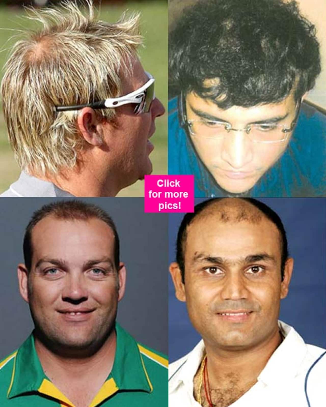 Sourav Ganguly, Jacques Kallis, Virender Sehwag, Doug Bollinger- 10  cricketers who went for hair transplant - Bollywood News & Gossip, Movie  Reviews, Trailers & Videos at 