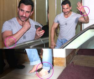Saif Ali Khan INJURED on the sets of Rangoon? View HQ pics!