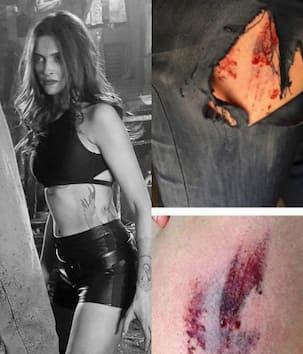 Look who got INJURED on the sets of Deepika Padukone's xXx: The Return Of Xander Cage!