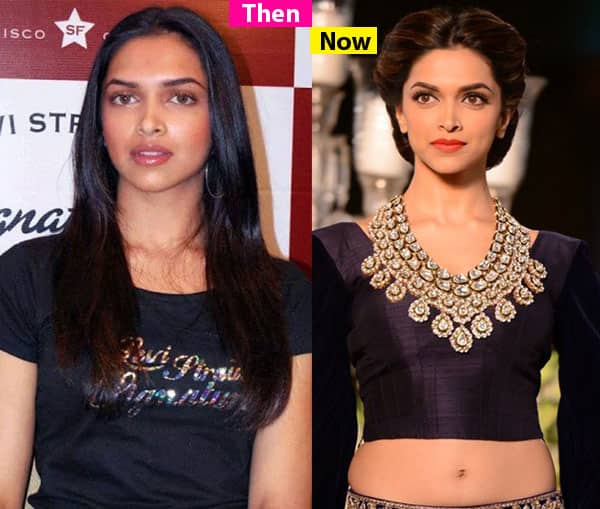  Deepika  Padukone  Plastic Surgery  Before  And After 