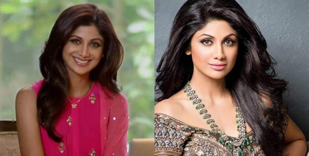 Bollywood actresses and their amazing nose jobs