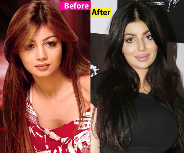 These 7 Actresses looks so Different nw after Surgery