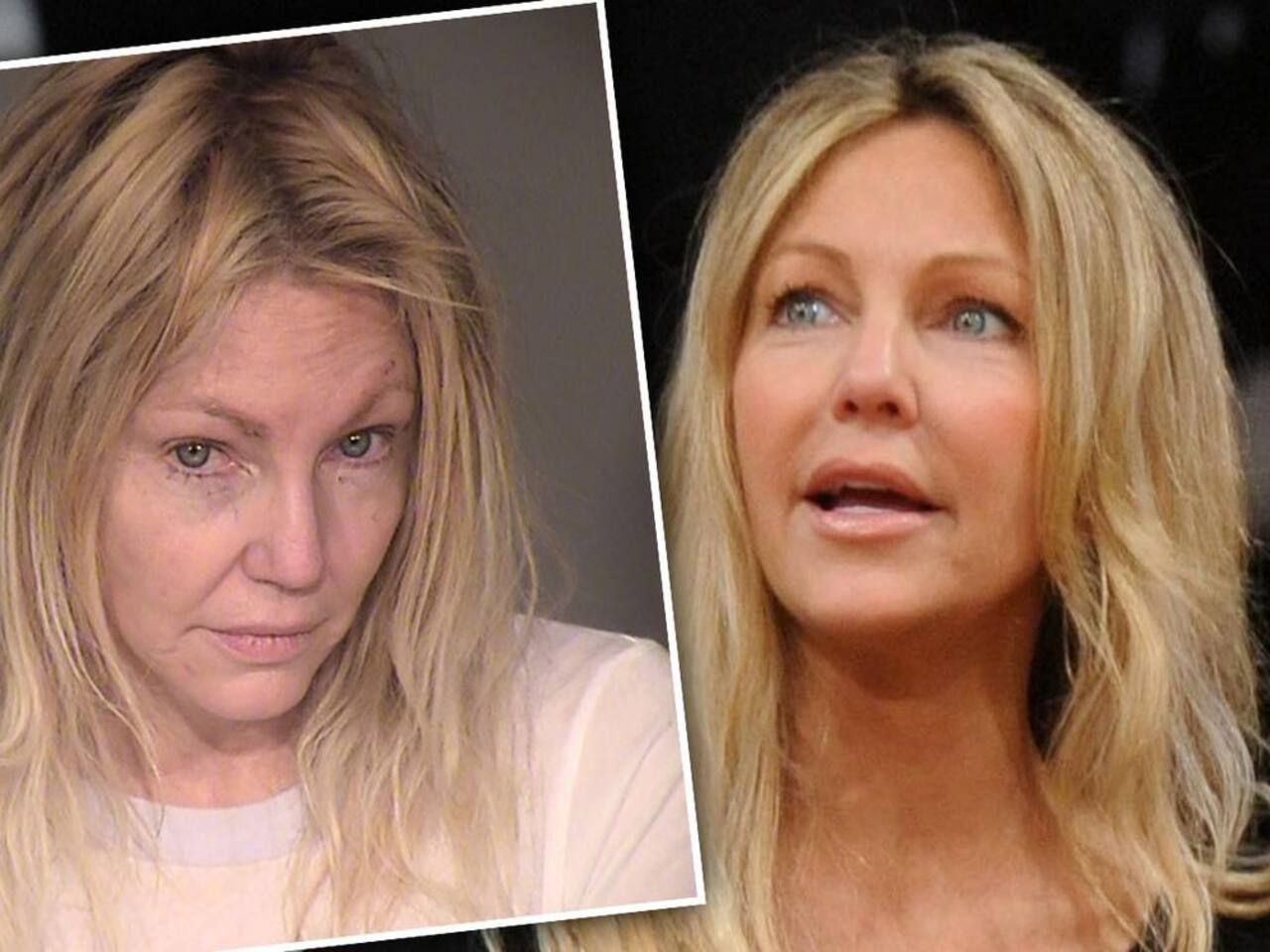 Heather Locklear Hospitalised Due To Possible Overdose After Her 