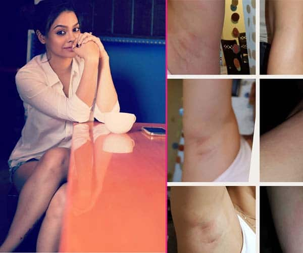 The Kapil Sharma Show S Sumona Chakravarti Suffers Bruises Lashes Out At A Beauty Service Provider Bollywood News Gossip Movie Reviews Trailers Videos At Bollywoodlife Com