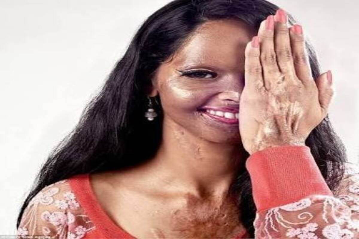 Here's all you need to know about acid attack survivor Lakshmi ...