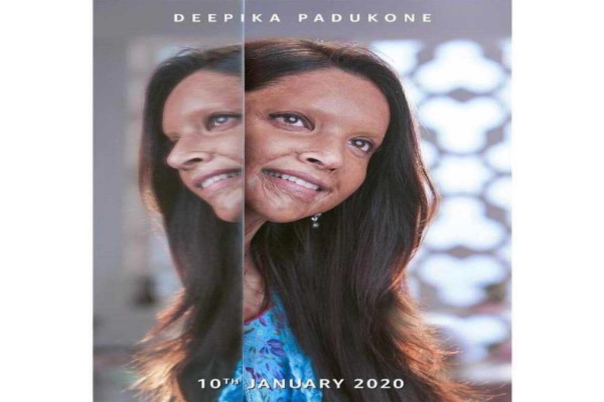Deepika Padukone Will Make Your Heart Cry Fans React To Chhapaak S First Look Read Tweets Bollywood News Gossip Movie Reviews Trailers Videos At Bollywoodlife Com fans react to chhapaak s first look