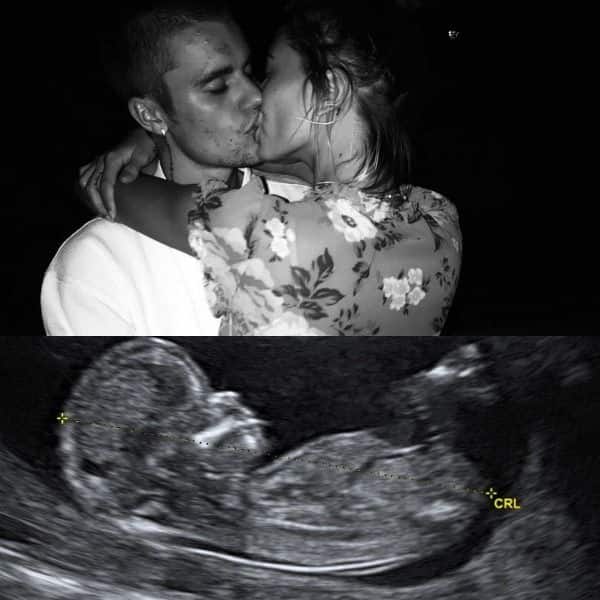 Justin Bieber S April Fool S Day Pregnancy Prank With An Ultrasound Reveal Takes The Trophy Home Bollywood News Gossip Movie Reviews Trailers Videos At Bollywoodlife Com