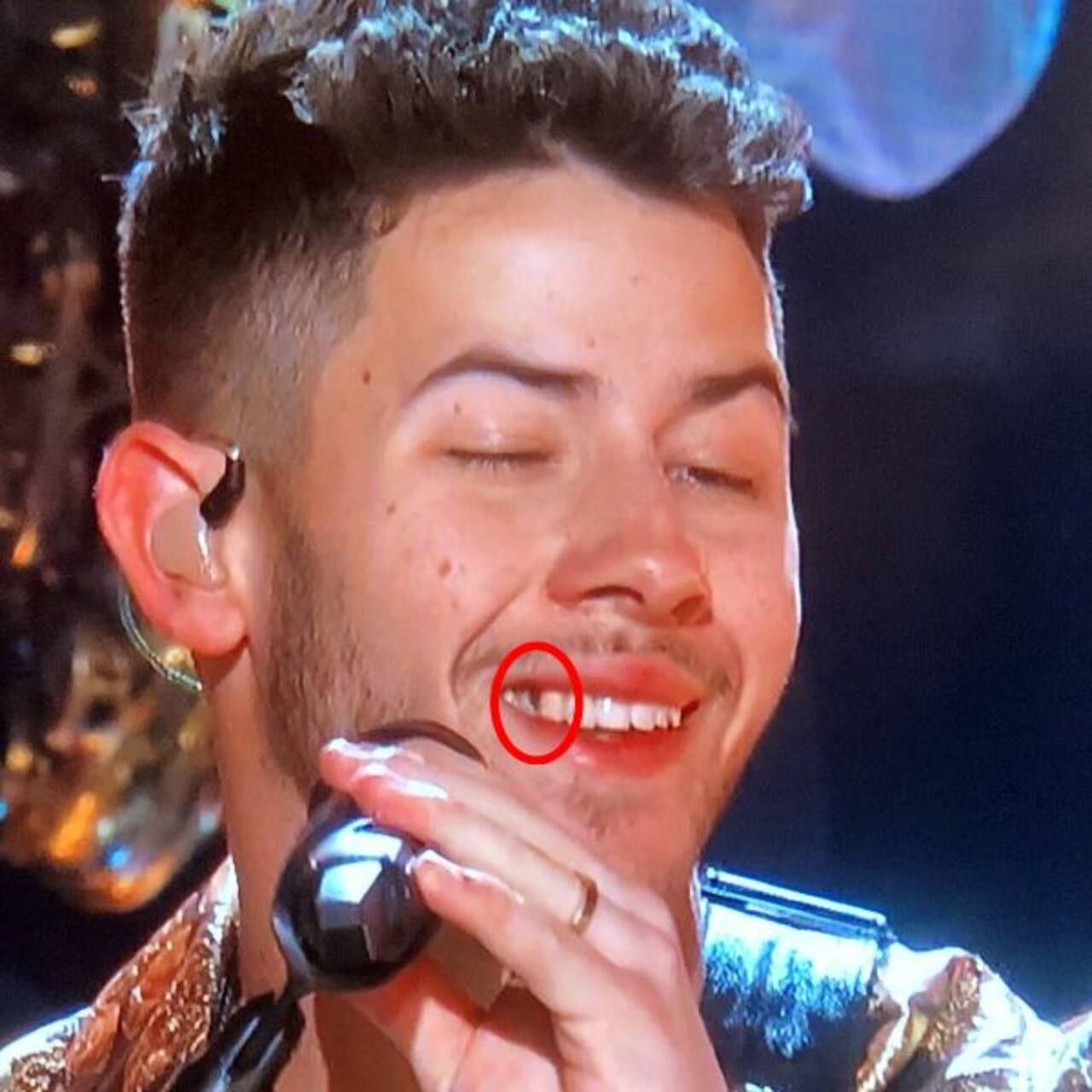 Grammys 2020 Nick Jonas having food stuck in his teeth while
