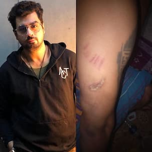 Bigg Boss 8 finalist, Pritam Singh, gets beaten up for rescuing a couple