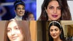 Priyanka Chopra Jonas to Shruti Haasan: You Will Be Shocked How Lip Jobs Changed These 5 Actresses!