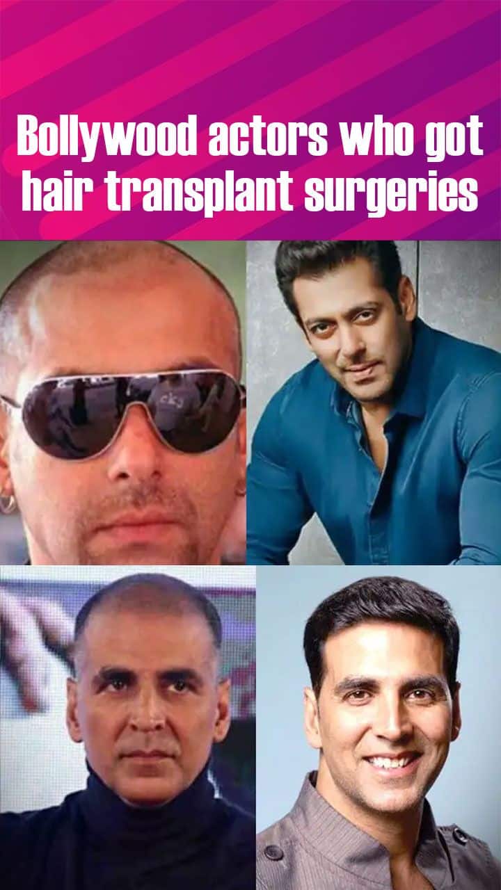 Salman Khan to Akshay Kumar: These 5 Bollywood actors underwent hair  transplant