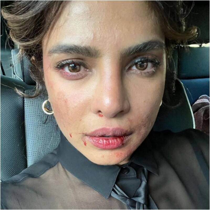 Citadel: Priyanka Chopra shares a bruised and intense picture from the sets; terms it a 'tough day' [View Post]