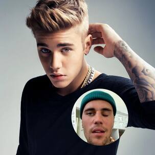 जस्टिन बीबर के आधे चेहरे को मार गया लकवा, अब ऐसी हो गई है हालत