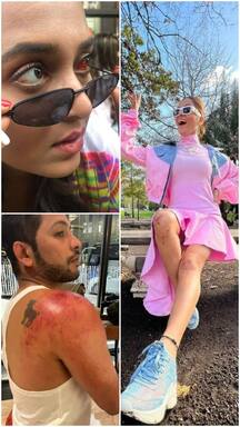 Khatron Ke Khiladi में घायल हुए ये सितारे, किसी की फूटी आंख तो किसी पर अजगर ने किया वार