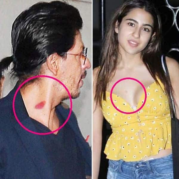 Bollywood celebs and their famous love bite marks