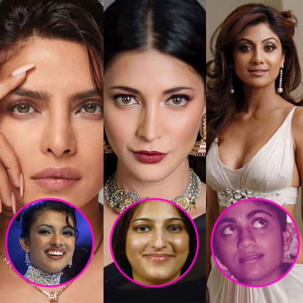 Actresses who underwent plastic surgeries