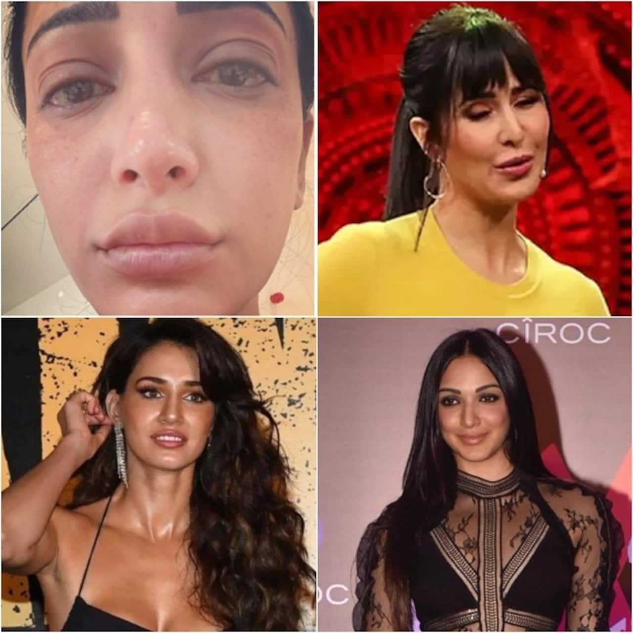 Bollywood actresses proudly flaunted their bloated faces