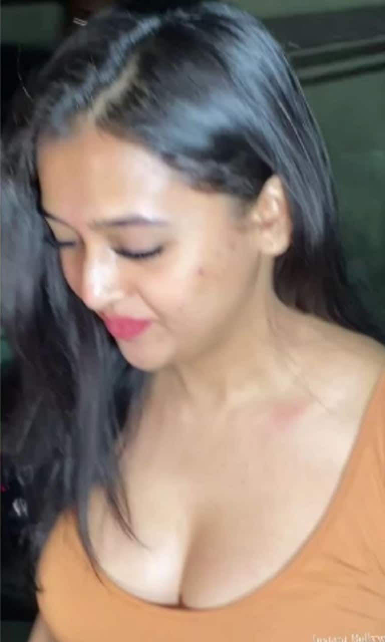 Tejasswi Prakash caught with love bite, marriage with Karan Kundrra