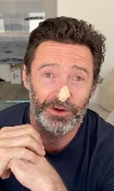 Hugh Jackman undergoes skin cancer test, pleads fans to follow sun safety: Top 10 updates