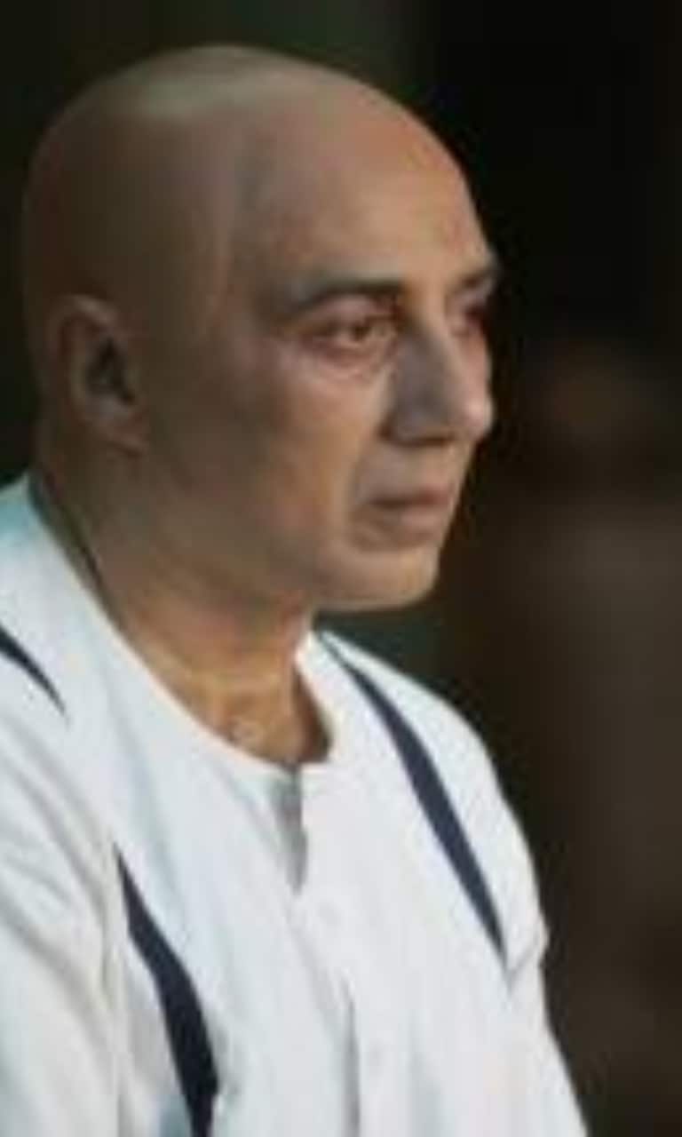 SHOCKING! Ranbir Kapoor Is Using A Wig Cause Of Balding? 