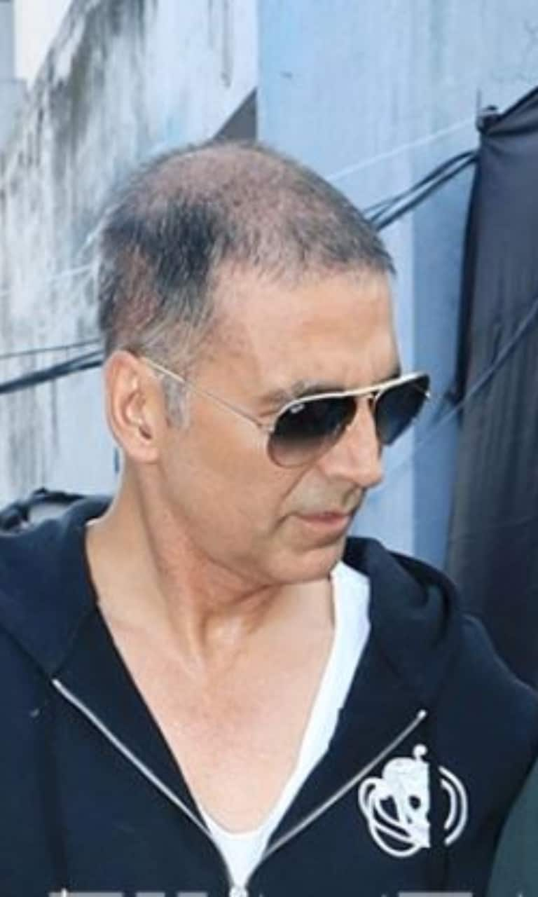 Bollywood celebrities went bald and had to wear wig and get hair