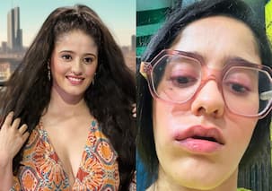 गुम है किसी के प्यार में फेम आयशा सिंह का बिगड़ा चेहरा, 'सई' की ये फोटोज देख फैंस बोले- 'क्या हो गया इसे?'