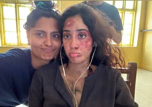 जाह्नवी कपूर के चेहरे पर लगी गहरी चोट! एक्ट्रेस की हालत देख घबराए फैंस