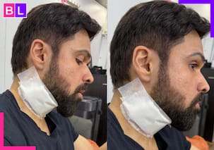 Emraan Hashmi शूटिंग के दौरान हुए घायल, गर्दन पर गहरा कट देखकर फैंस हुए परेशान