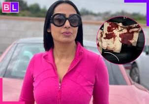 भयंकर हादसे की शिकार हुईं Kashmera Shah, खून से सने कपड़े देख फैंस के पैरों तले खिसकी जमीन