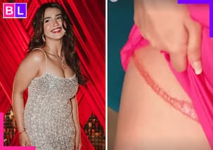 TV Star Roshni Walia suffers painful injury after her dress gets trapped...