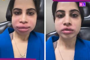 Urfi Javed undergoes procedure to..., looks unrecognisable in viral video: 'They were misplaced...'