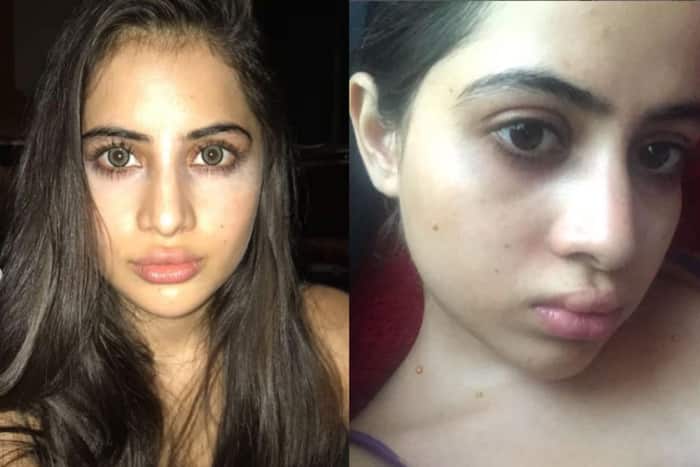 Urfi Javed removes lip fillers