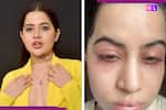 Uorfi Javed had undergone surgery to not just dissolves lip fillers, but also reduce...: 'Abhi maine sab...'