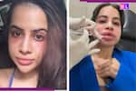 Did Uorfi Javed’s cosmetic procedures trigger body dysmorphia? Her struggle with mental health is...: 'I stopped...'