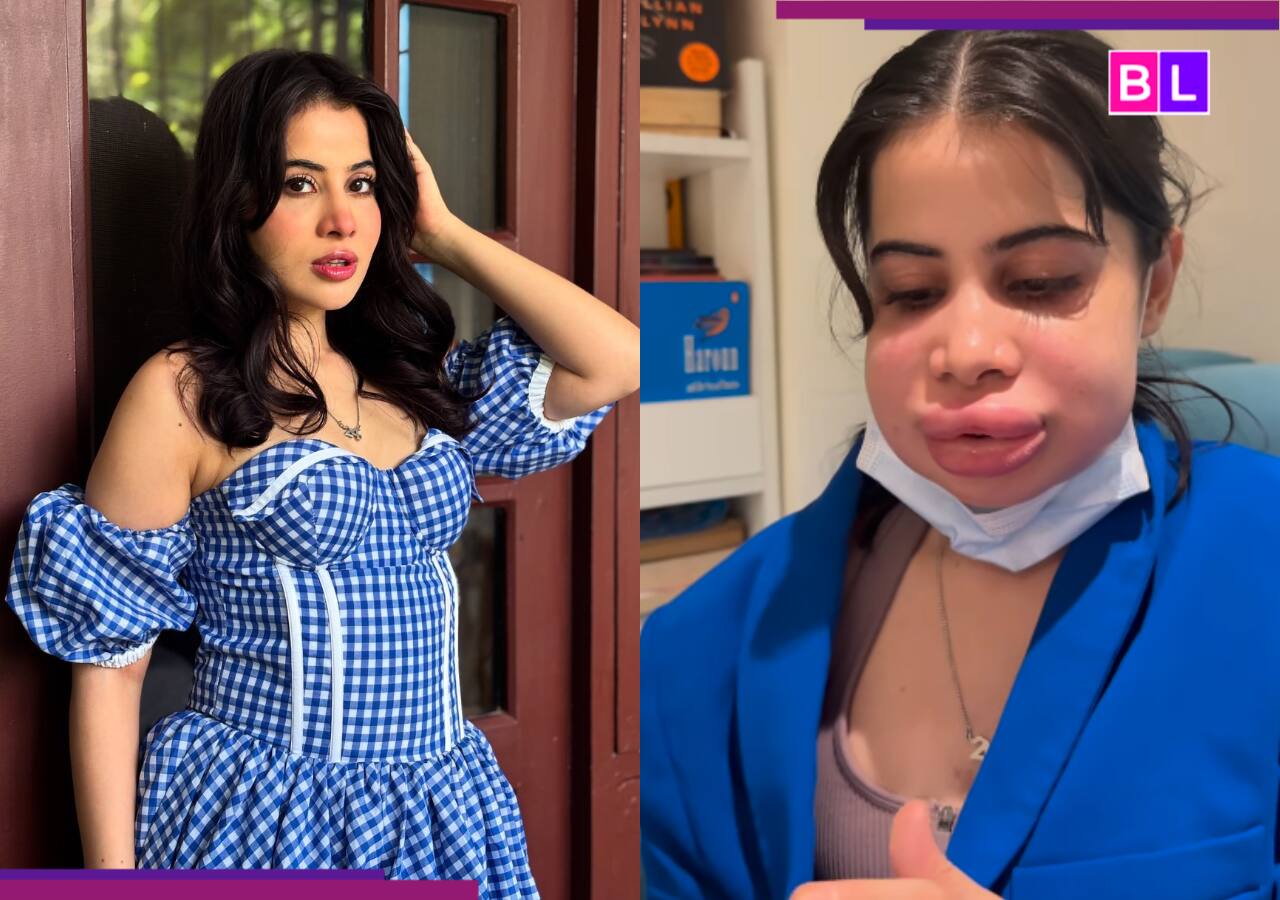 Uorfi Javed Shares Recent Photos After Lip Filler Removal