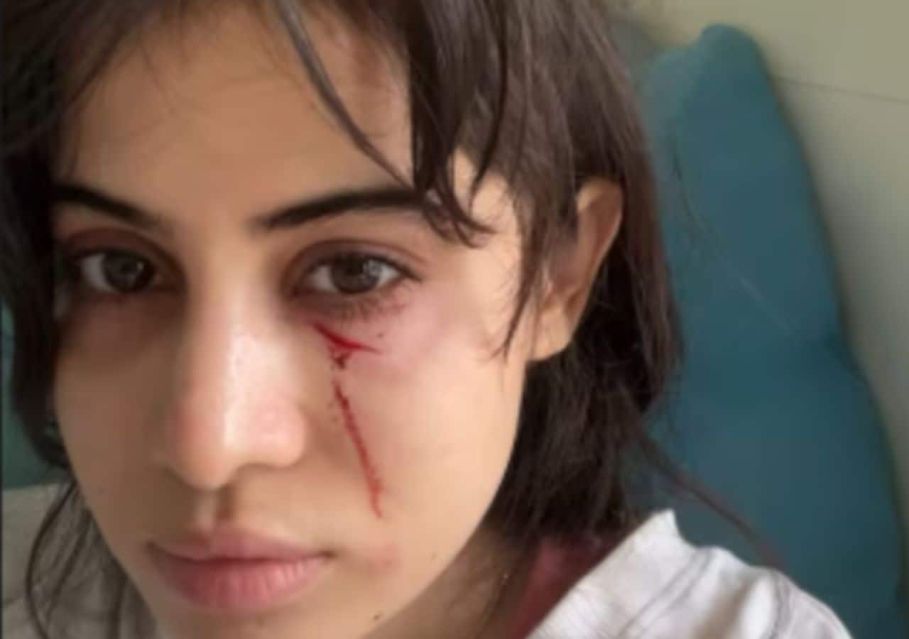 Urfi Javed Viral Scary Video: रक्तानं माखलेला चेहरा, डोळ्याखाली जखमा... उर्फीला नेमकं झालंय काय?