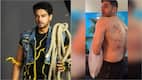 Khatron Ke Khiladi 15: Makers REACT after Gaurav Khanna's injury video goes viral, says 'Not at all brutal'