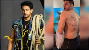 Khatron Ke Khiladi 15: Makers REACT after Gaurav Khanna's injury video goes viral, says 'Not at all brutal'